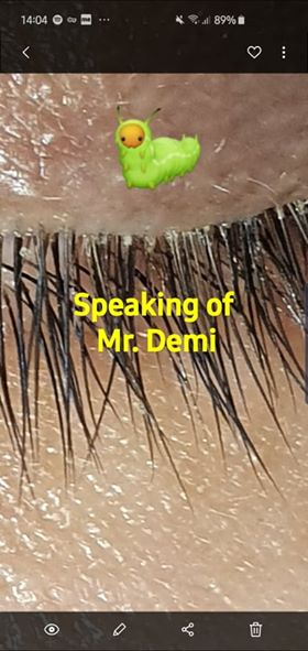 Searching for Mr Demodex der optik inspektor mites blepharitis