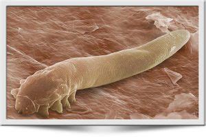 demodex milbe mites der optik inspektor