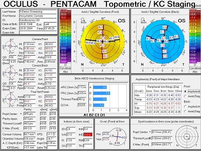 topography cornea der optik inspektor